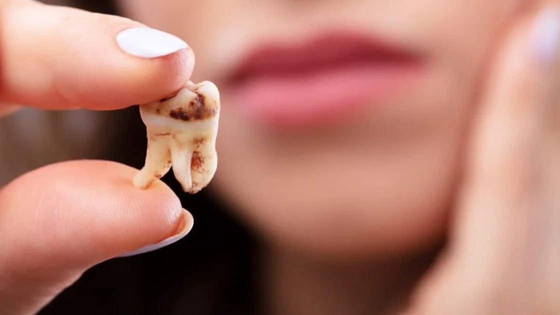 dientes, dientes flojos, consejos, salud bucal